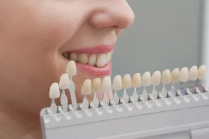 tooth coloured fillings brisbane