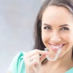clear aligners