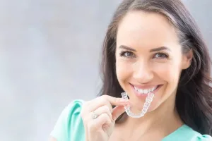 clear aligners