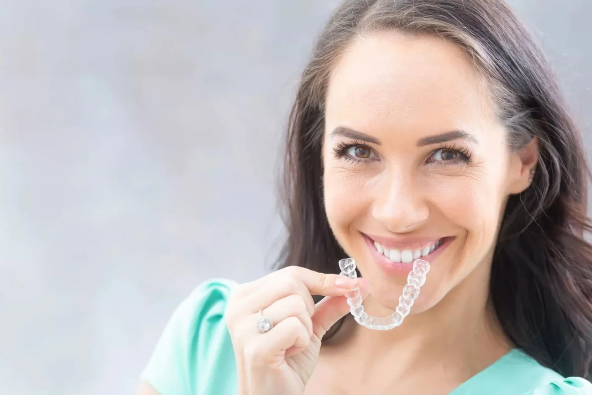 clear aligners
