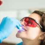 Tooth Coloured Fillings