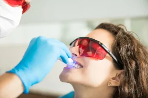 Tooth Coloured Fillings