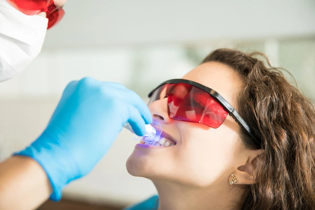 Tooth Coloured Fillings