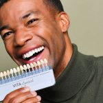 Veneers