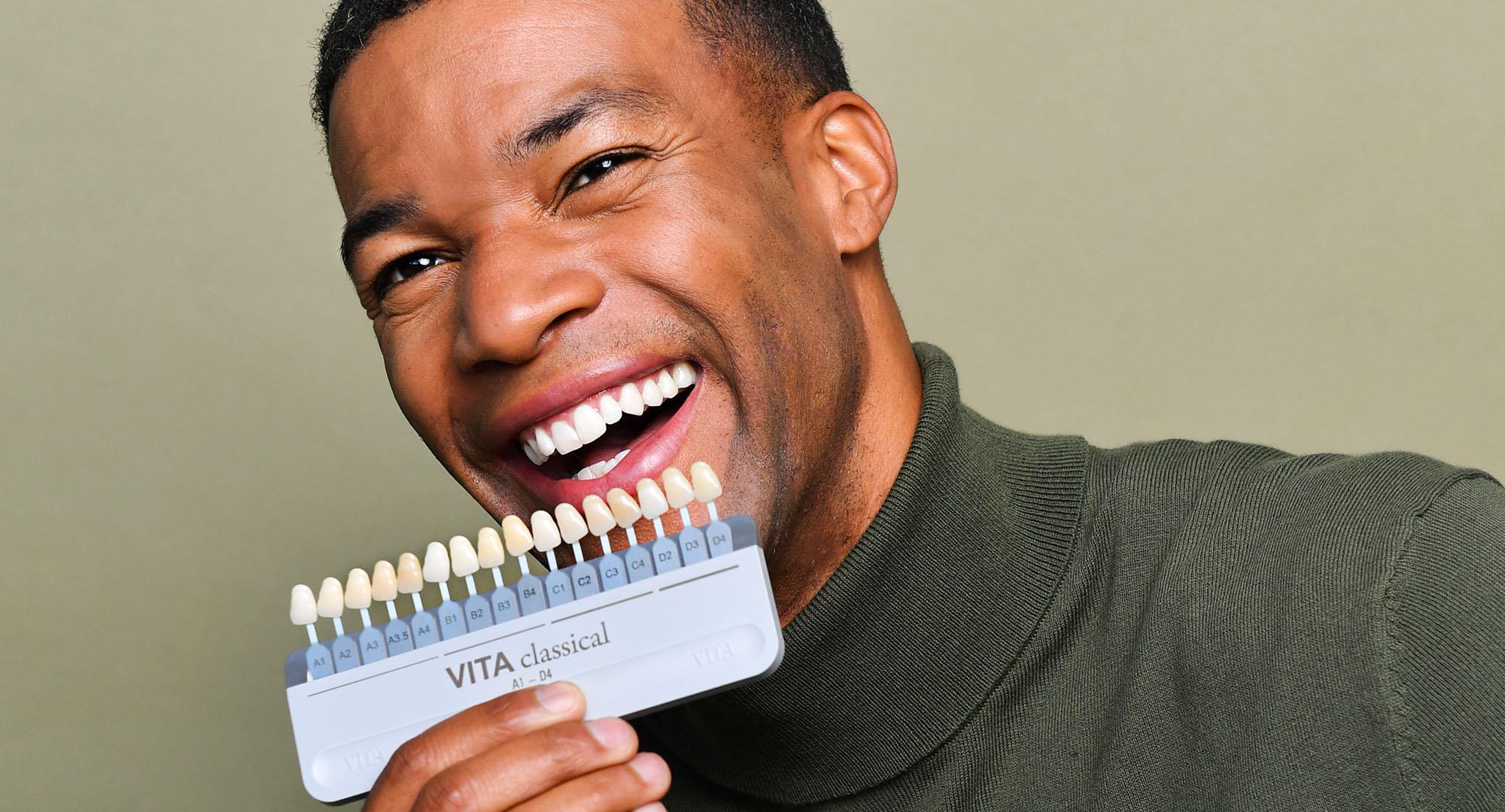 Veneers