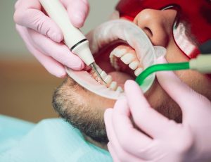 Dental Checkup and Clean