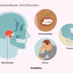 TMJ