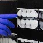 Digital Dental X-Rays brisbane