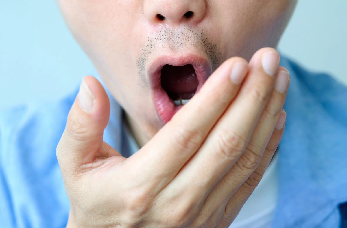 Bad Breath (Halitosis)