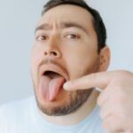 Burning Tongue
