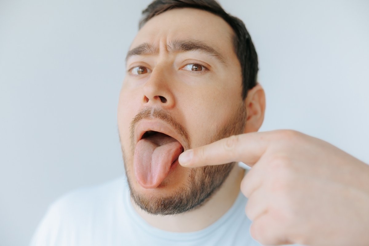 Burning Tongue